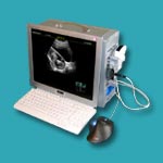 Portable Ultrasound Scanner SonoFly-3000M